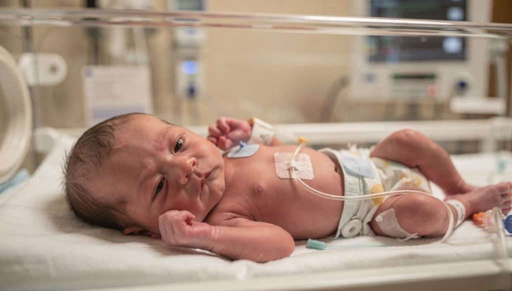 Risques des naissances prématurées : 3 choses essentielles à savoir